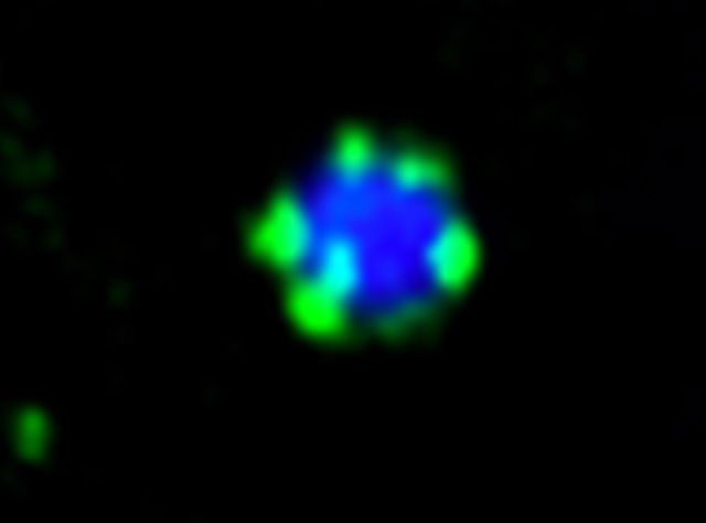 Bild Fluoreszenzmikroskop: Das Molekül Atg11 (grün) bildet kleine Tröpfchen auf der Oberfläche eines Protein-Aggregats (blau)
