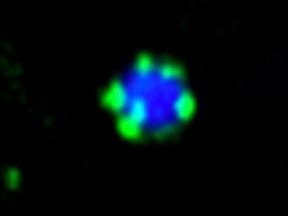 Bild Fluoreszenzmikroskop: Das Molekül Atg11 (grün) bildet kleine Tröpfchen auf der Oberfläche eines Protein-Aggregats (blau)