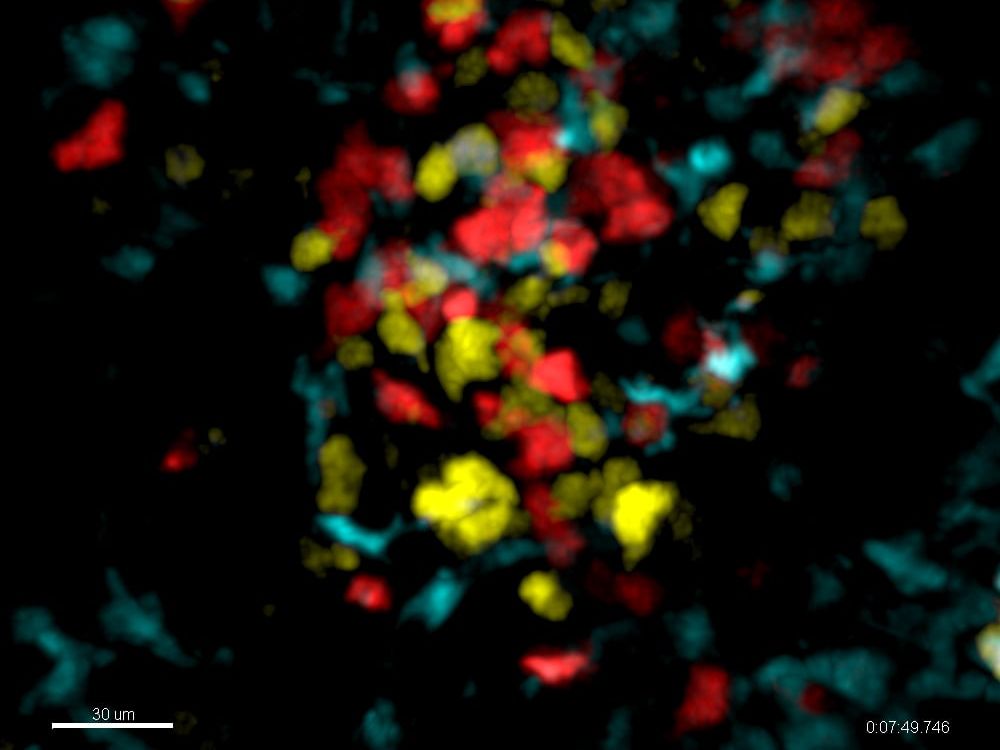 Neue Phase der Immunantwort entdeckt CD8-T-Zellen (rot) treffen erneut auf antigenpräsentierende Zellen (cyan), wo sie von CD4-T-Zellen (gelb) mit IL-2 versorgt werden