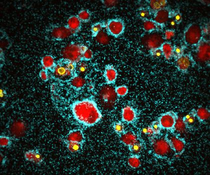 Bakteriologie: Neuartiger, aggressiver Biofilm auf Immunzellen entdeckt Vibrio cholerae bildet einen Biofilm