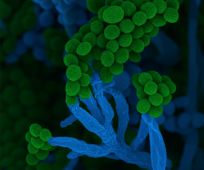 Mikrobe des Jahres 2026: Penicillium – lebensrettender Pinselschimmel Raster elektronenmikroskopische Aufnahme Penicillium, rund 5000fach vergrößert, nachträglich eingefärbt.