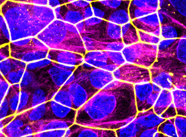Neue Nanomedikamente zur Behandlung von Entzündungsprozessen in der Schwangerschaft Das Plazenta-Modell unter dem Fluoreszenzmikroskop (blau: Zellkerne; gelb: Zell-zu-Zell-Kontakte).