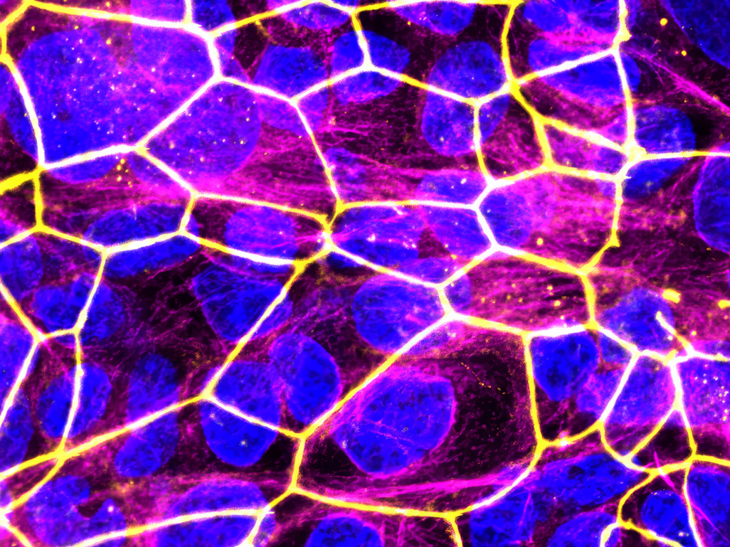 Neue Nanomedikamente zur Behandlung von Entzündungsprozessen in der Schwangerschaft Das Plazenta-Modell unter dem Fluoreszenzmikroskop (blau: Zellkerne; gelb: Zell-zu-Zell-Kontakte).