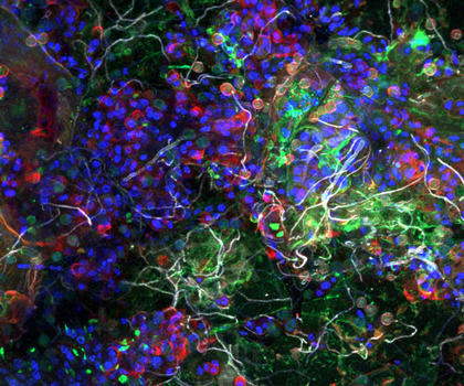 Wie Mikroben im Plastikmeer überleben: Forschende untersuchen die Plastisphäre als globales Mikro-Ökosystem Aufnahme der Plastisphäre eines Partikels aus dem Pazifischen Ozean mittels eines konfokalen Laser-Scanning-Mikroskops. Das Bild zeigt die biologischen Bestandteile (angefärbt), die in unmittelbarer räumlicher Nähe koexistieren: Bakterien (grün), Algen (blau), extrazelluläre Zuckermatrix (rot), Pilzhyphen (weiß).