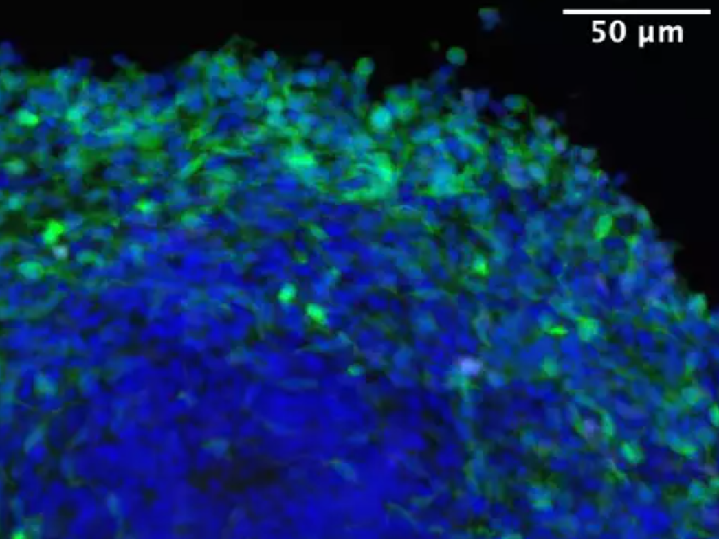 Gehirnorganoid das synthetischen Glukokortikoiden ausgesetzt wurde Ein Gehirnorganoid, das synthetischen Glukokortikoiden ausgesetzt wurde. Viele hemmende Neuronen (in Grün) sind sichtbar.