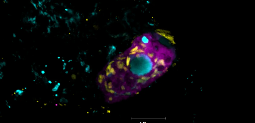 Belasten Kläranlagen das Klima? Symbiotische Bakterien klären Abwasser und erzeugen Treibhausgase Der Endosymbiont Candidatus Azoamicus mariagerensis und sein Ciliatenwirt unter dem Fluoreszenzmikroskop.