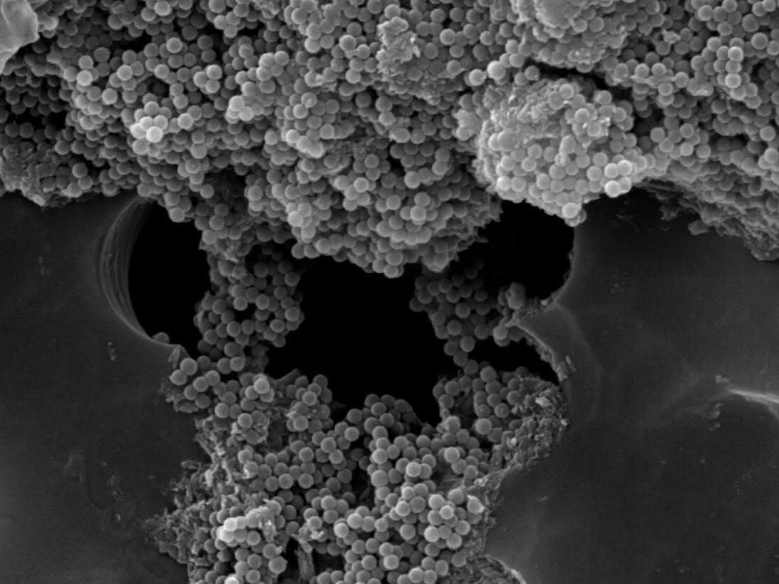Polystyrol-Nanopartikel (Rasterelektronenmikroskopische Aufnahme) Polystyrol-Nanopartikel (Rasterelektronenmikroskopische Aufnahme)