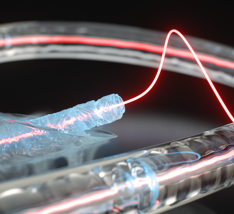 Neue Glasfasertechnologie: Ein ungewöhnlicher Materialzustand eröffnet neue Wege für photonische Systeme Künstlerische Darstellung eines gefrorenen Glasfaserkerns in einer Glaskapillare, der Licht- und Schallwellen effizient leitet und koppelt.