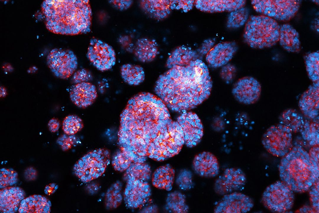 Organoid-Kultur mit Organoiden unterschiedlicher Größe und Zellzusammensetzung