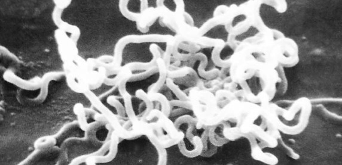 Treponema pallidum subsp. pallidum unter dem Mikroskop