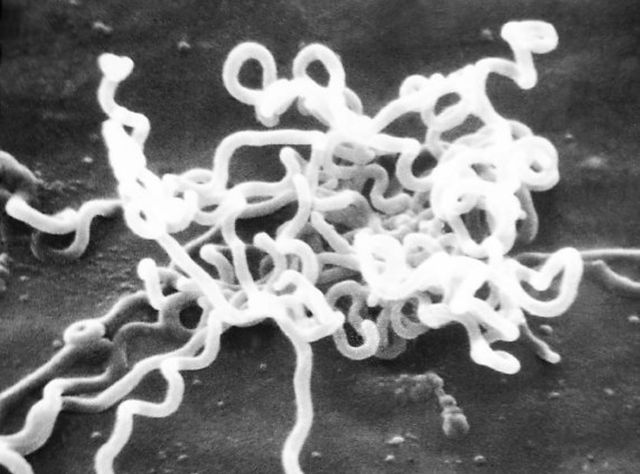 Treponema pallidum subsp. pallidum unter dem Mikroskop