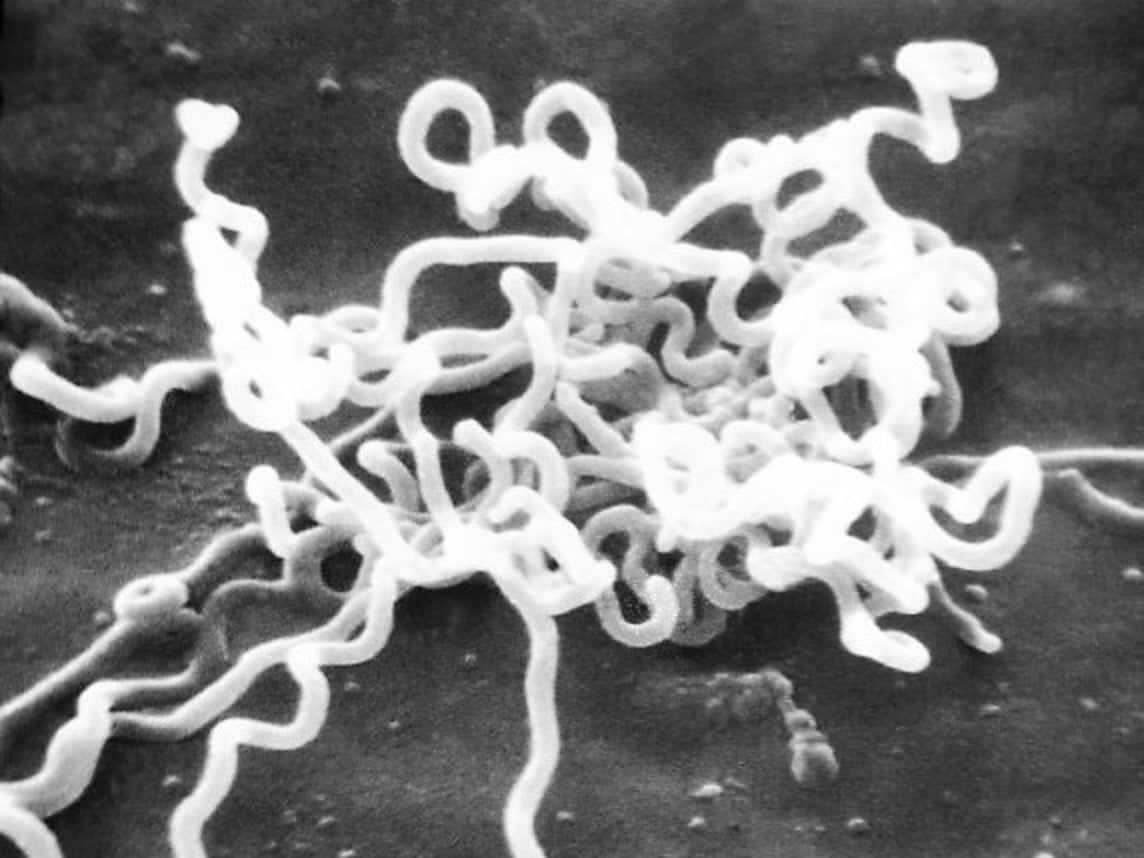 Treponema pallidum subsp. pallidum unter dem Mikroskop Treponema pallidum subsp. pallidum unter dem Mikroskop