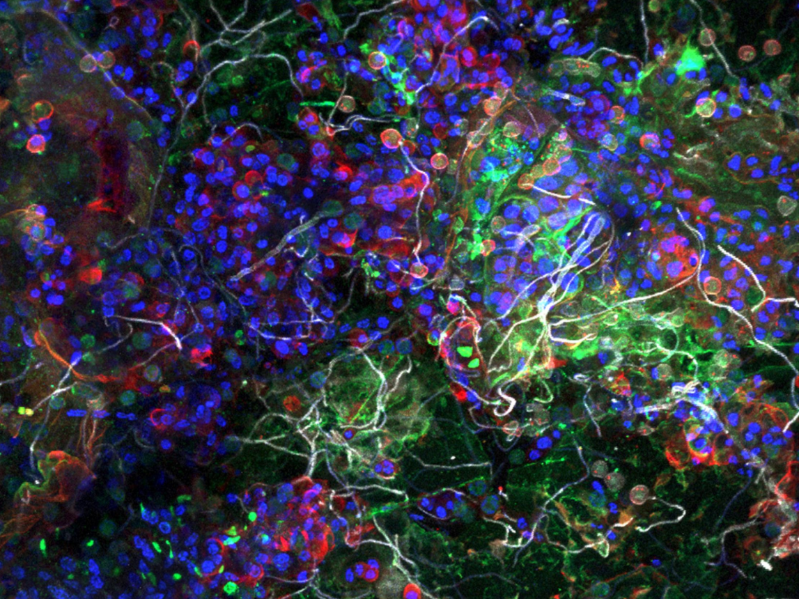 Wie Mikroben im Plastikmeer überleben: Forschende untersuchen die Plastisphäre als globales Mikro-Ökosystem Aufnahme der Plastisphäre eines Partikels aus dem Pazifischen Ozean mittels eines konfokalen Laser-Scanning-Mikroskops. Das Bild zeigt die biologischen Bestandteile (angefärbt), die in unmittelbarer räumlicher Nähe koexistieren: Bakterien (grün), Algen (blau), extrazelluläre Zuckermatrix (rot), Pilzhyphen (weiß).