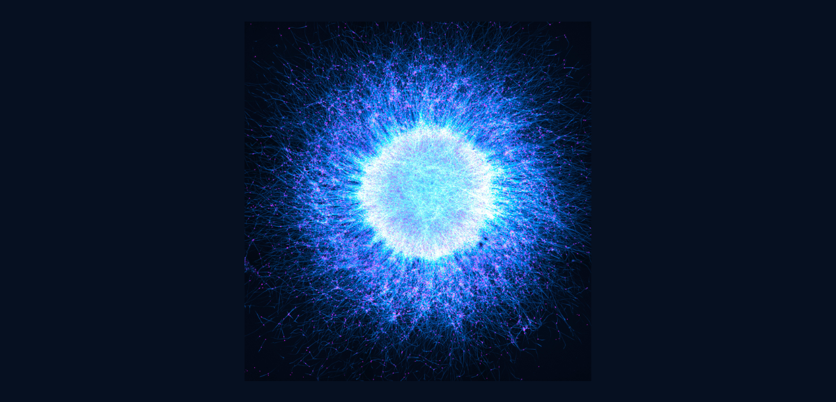 Image of the Year Award: Evident zeichnet das Mikroskopie-Bild des Jahres aus Katie Holden aus dem Vereinigten Königreich wurde als globale Gewinnerin für ihr beeindruckendes Bild mit dem Titel „Neuronal Cosmos“ gekürt. Das Bild zeigt aus induzierten pluripotenten Stammzellen gewonnene Neurosphären, die aus neuronalen Zellen bestehen, und sich selbstorganisierend zu Strukturen anordnen, die der geschichteten Architektur des menschlichen Gehirns ähneln.