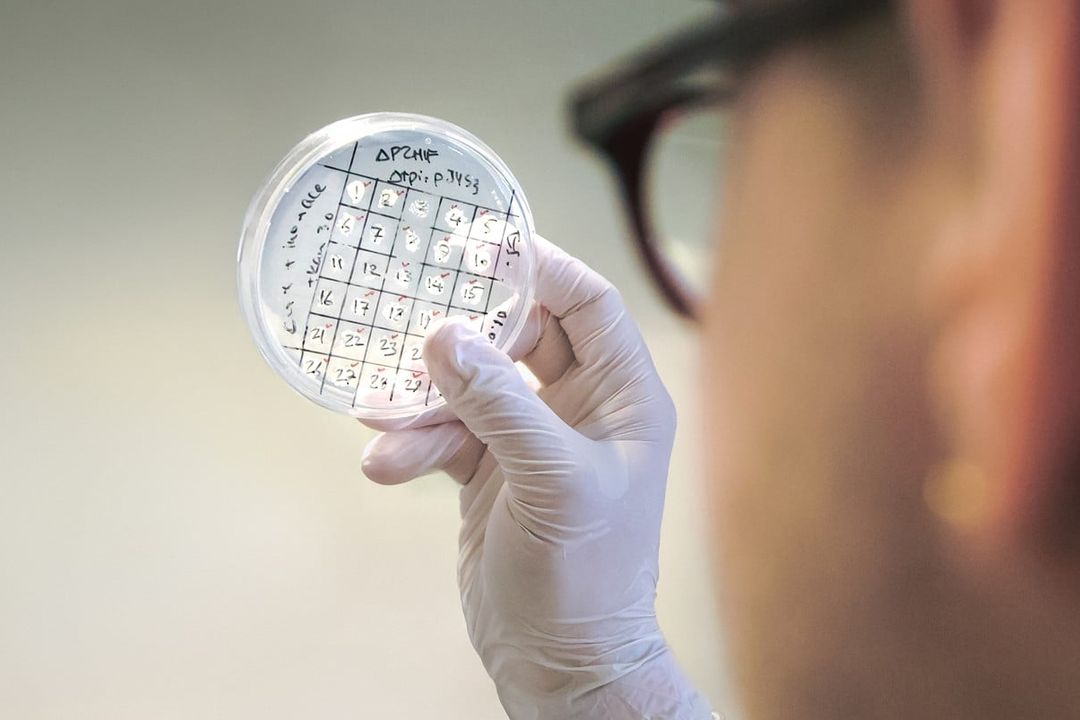 EU-Projekt für nachhaltige Chemikalien-Herstellung: Mit Bakterien zu klimaneutralen Kunststoffen und Kosmetika? Behandschuhte Hand hält Petrischale hoch, in der Bakterienstämme wachsen