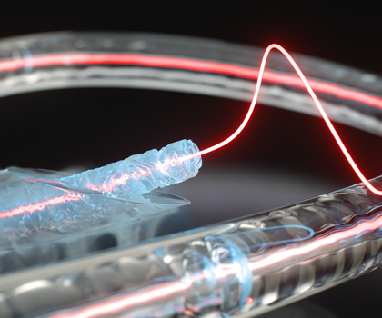 Neue Glasfasertechnologie: Ein ungewöhnlicher Materialzustand eröffnet neue Wege für photonische Systeme Künstlerische Darstellung eines gefrorenen Glasfaserkerns in einer Glaskapillare, der Licht- und Schallwellen effizient leitet und koppelt.
