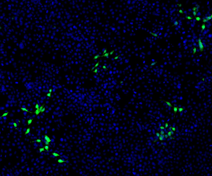 Virus auf Abwegen: Hepatitis E repliziert auch in Nierenzellen Mit HEV infizierte Nierenzellen sind mit einem grünen Fluoreszenzfarbstoff markiert. Nicht infizierte Zellen sind blau angefärbt.