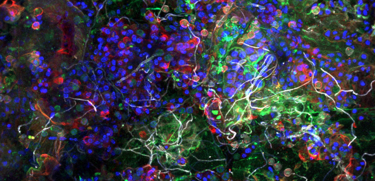 Aufnahme der Plastisphäre eines Partikels aus dem Pazifischen Ozean mittels eines konfokalen Laser-Scanning-Mikroskops. Das Bild zeigt die biologischen Bestandteile (angefärbt), die in unmittelbarer räumlicher Nähe koexistieren: Bakterien (grün), Algen (blau), extrazelluläre Zuckermatrix (rot), Pilzhyphen (weiß).