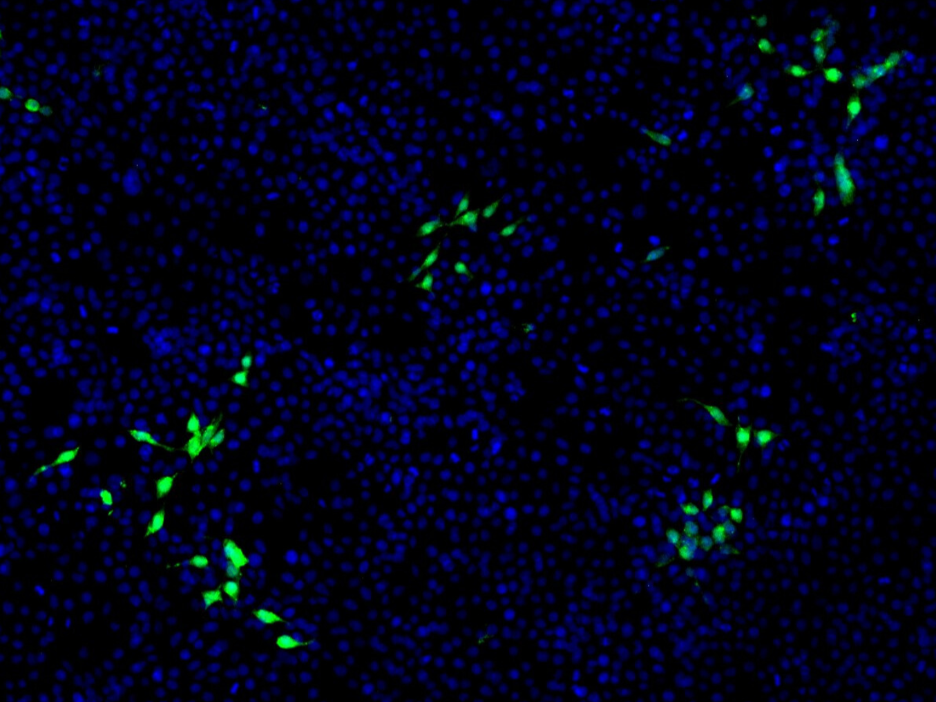 Mit HEV infizierte Nierenzellen sind mit einem grünen Fluoreszenzfarbstoff markiert. Nicht infizierte Zellen sind blau angefärbt.