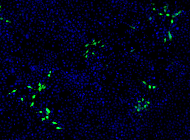 Virus auf Abwegen: Hepatitis E repliziert auch in Nierenzellen Mit HEV infizierte Nierenzellen sind mit einem grünen Fluoreszenzfarbstoff markiert. Nicht infizierte Zellen sind blau angefärbt.