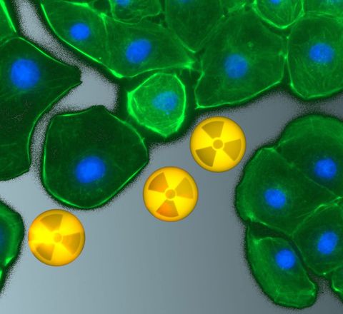 Fluoreszenzmikroskopische Aufnahme Fluoreszenzmikroskopische Aufnahme von Rattennierenzellen