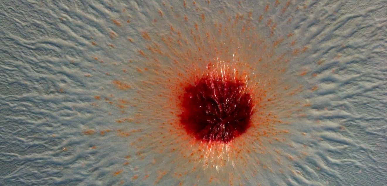 Mikroskopische Aufnahme einer Kolonie von Pendulispora rubella