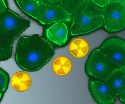 Fluoreszenzmikroskopische Aufnahme Fluoreszenzmikroskopische Aufnahme von Rattennierenzellen