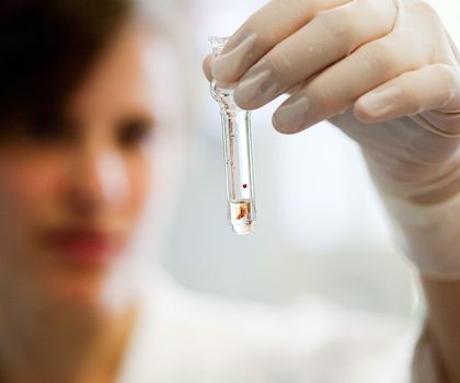 Fluoreszenzmikroskopie: Methode für die Protein-Analyse an Gewebeproben Forschung am UKE - Labormitarbeiterin hält Röhrchen in der Hand
