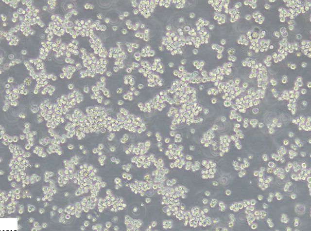 Weniger Tierleid in der Krebsforschung: Zellkulturmodelle ohne fötales Kälberserum Die Zelllinie HL-60 ist ein häufig verwendetes Modell für die akute myeloische Leukämie und kann in einem chemisch definierten Medium ohne den Einsatz von fötalem Kälberserum kultiviert und kryokonserviert werden.