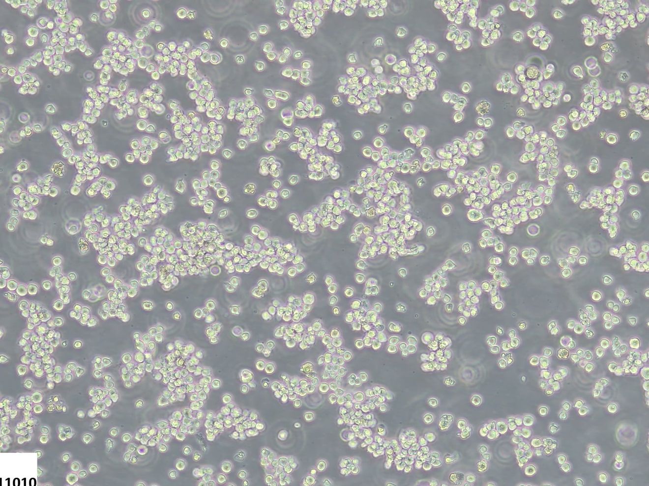 Weniger Tierleid in der Krebsforschung: Zellkulturmodelle ohne fötales Kälberserum Die Zelllinie HL-60 ist ein häufig verwendetes Modell für die akute myeloische Leukämie und kann in einem chemisch definierten Medium ohne den Einsatz von fötalem Kälberserum kultiviert und kryokonserviert werden.
