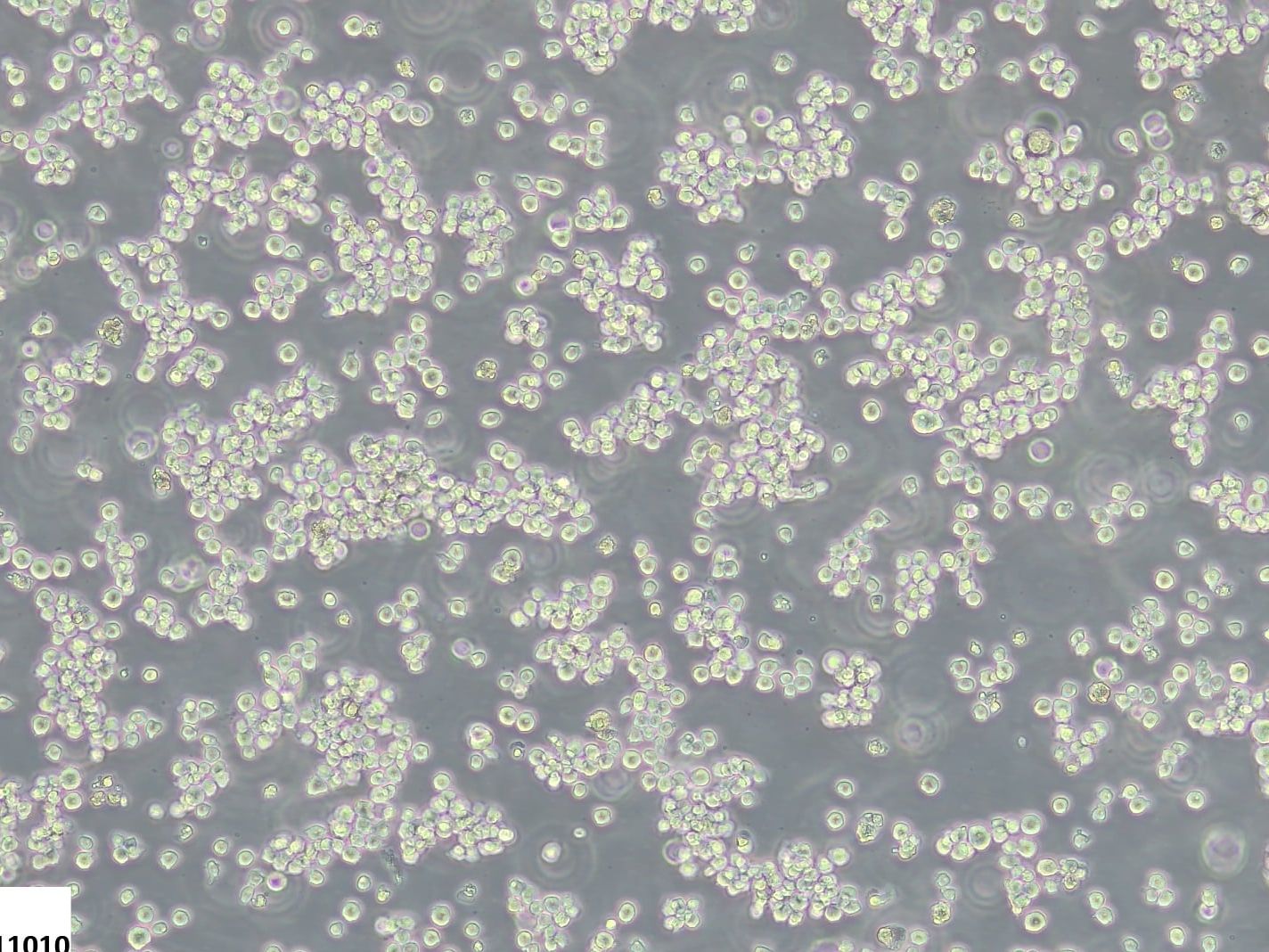 Weniger Tierleid in der Krebsforschung: Zellkulturmodelle ohne fötales Kälberserum Die Zelllinie HL-60 ist ein häufig verwendetes Modell für die akute myeloische Leukämie und kann in einem chemisch definierten Medium ohne den Einsatz von fötalem Kälberserum kultiviert und kryokonserviert werden.