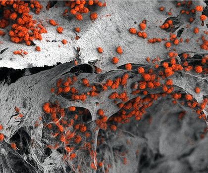 Menschliches Knochenmark im Labor nachgebildet - für humane Forschung und weniger Tierversuche Rasterelektronenmikroskopische Aufnahme des künstlich hergestellten 3D-Knochenmarkgewebes, das mit menschlichen Blutzellen (rot) besiedelt ist.