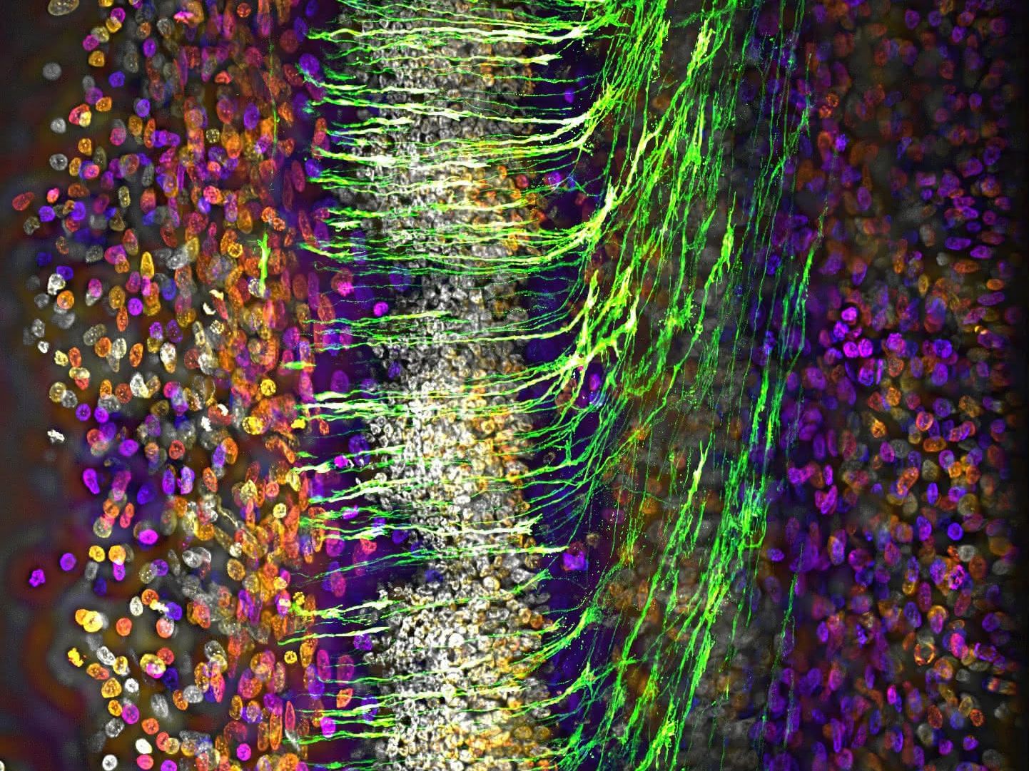 Ehrenhaft erwähnt im Wettbewerb Image of the Year wurde das Mikroskop-Bild Kommissurale Axone navigieren über die Mittellinie eines sich entwickelnden Zentralnervensystems im Hühnerembryo. Aufgenommen von Alexandre Dumoulin (Schweiz).