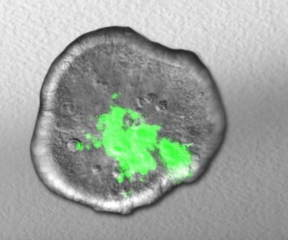 Infektionsforschung mit Organoiden aus dem Labor: Kolonisationsverhalten von Shigella untersucht Das Bild zeigt die Ausbreitung von Shigella (grün) im Laufe der Zeit in einem im Labor gezüchteten Miniaturdarm.