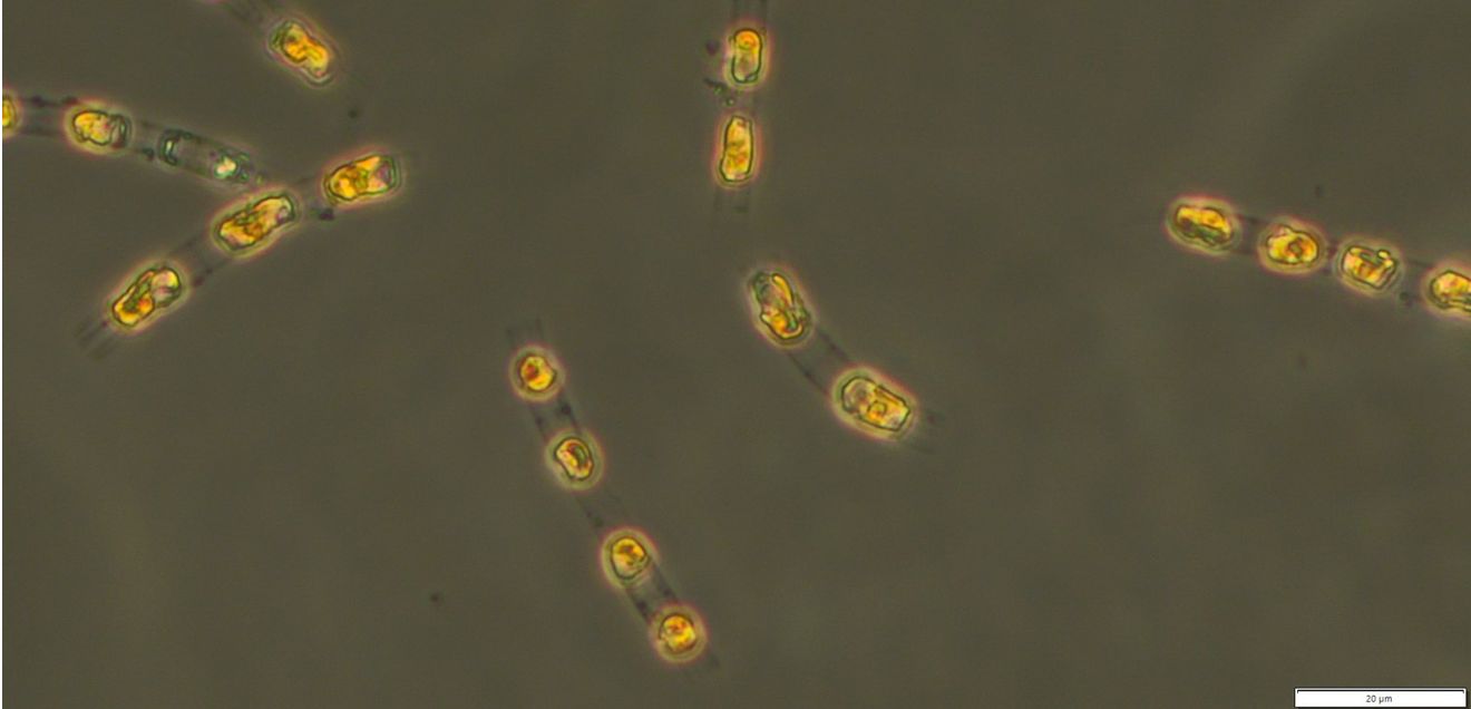 Kieselalge Skeletonema marinoi Kieselalge Skeletonema marinoi