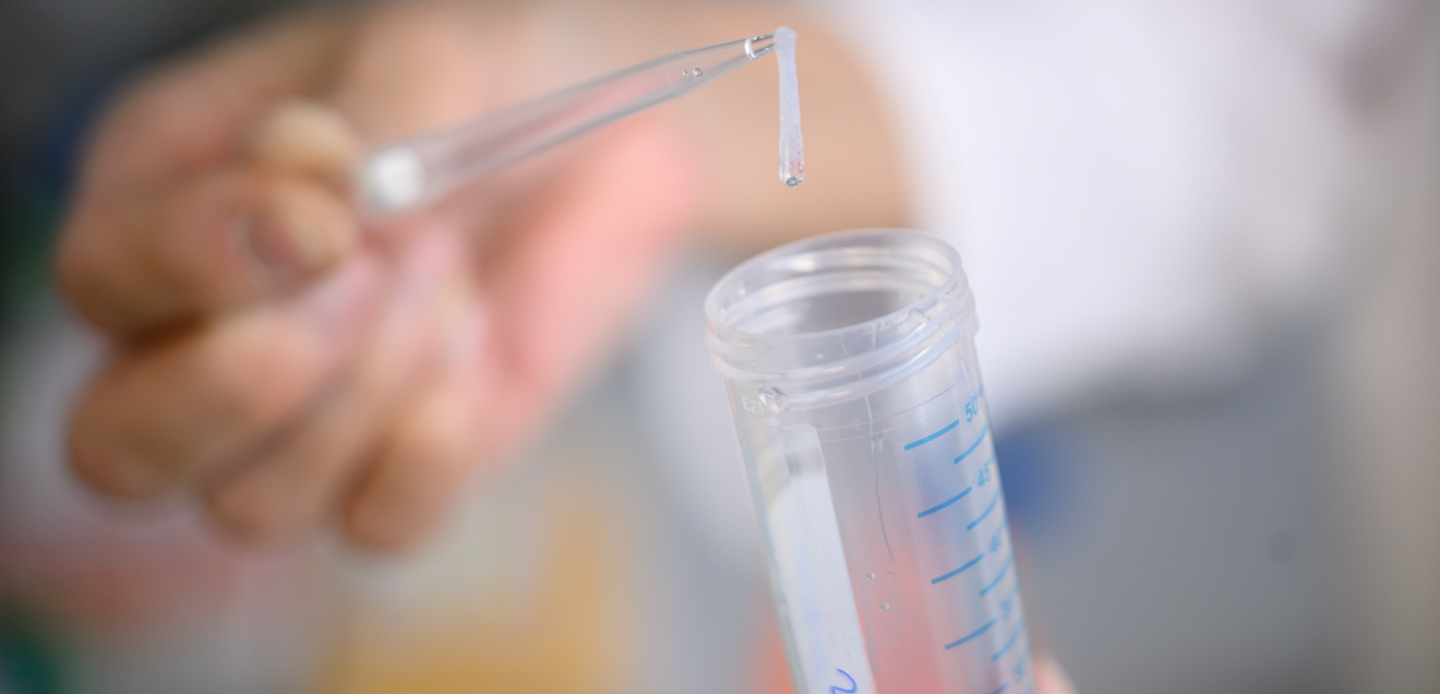 Bisher größte Studie zu Angsterkrankungen identifiziert neue genetische Ursachen von Angst Bei der Genanalyse von 693.869 Menschen europäischer Abstimmung fand das Studienteam die bislang größte Anzahl genetischer Zusammenhänge mit Angstzuständen.
