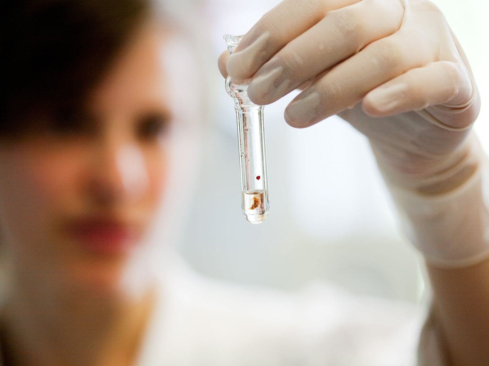 Forschung am UKE - Labormitarbeiterin hält Röhrchen in der Hand