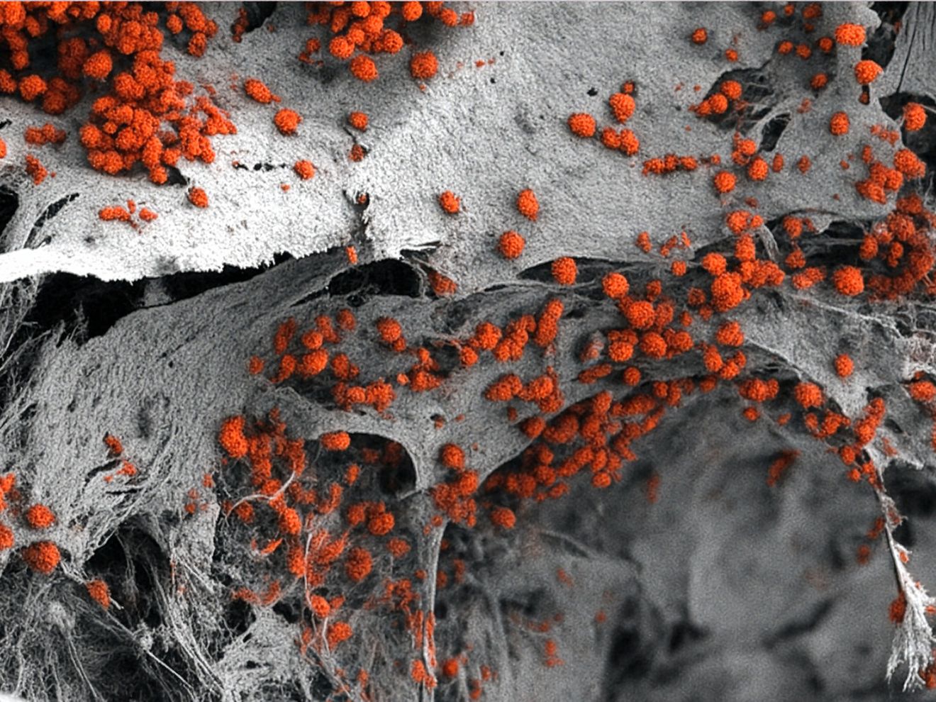 Menschliches Knochenmark im Labor nachgebildet - für humane Forschung und weniger Tierversuche Rasterelektronenmikroskopische Aufnahme des künstlich hergestellten 3D-Knochenmarkgewebes, das mit menschlichen Blutzellen (rot) besiedelt ist.