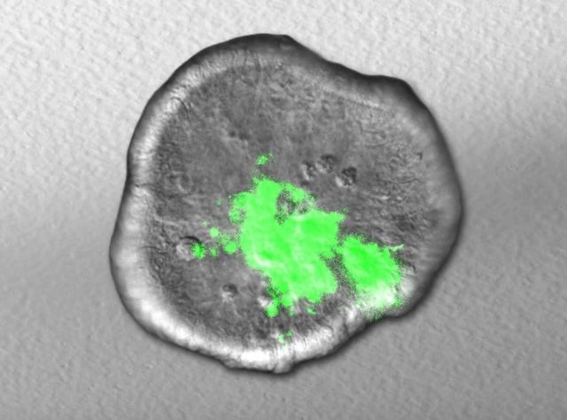 Infektionsforschung mit Organoiden aus dem Labor: Kolonisationsverhalten von Shigella untersucht Das Bild zeigt die Ausbreitung von Shigella (grün) im Laufe der Zeit in einem im Labor gezüchteten Miniaturdarm.