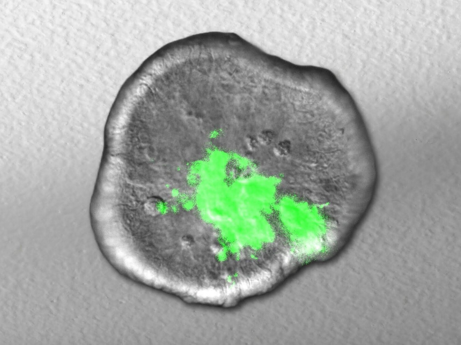 Infektionsforschung mit Organoiden aus dem Labor: Kolonisationsverhalten von Shigella untersucht Das Bild zeigt die Ausbreitung von Shigella (grün) im Laufe der Zeit in einem im Labor gezüchteten Miniaturdarm.