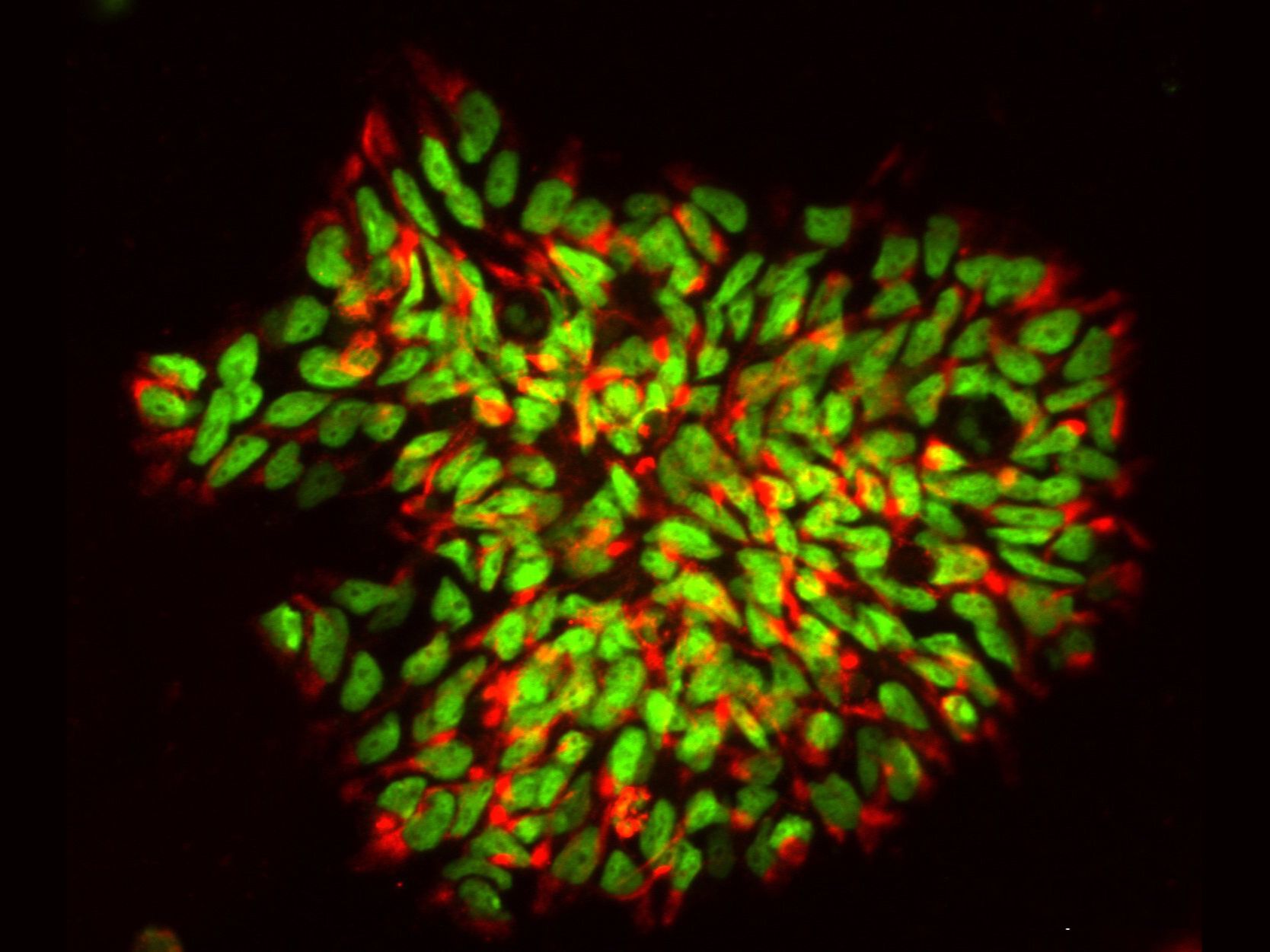 Multiple Sklerose: Humane induzierte neurale Stammzellen, die aus Hautzellen reprogrammmiert wurden. Humane induzierte neurale Stammzellen, die aus Hautzellen reprogrammmiert wurden.