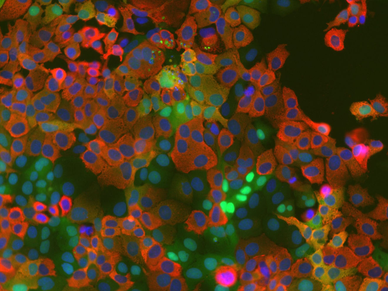Neuer Ansatz gegen Coronaviren: Forscher entdecken Schlüsselmolekül in der Virusvermehrung Zellkulturzellen, die einen Kinase-Aktivitätstreporter exprimieren (grün) nach Infektion mit dem humanen Coronavirus HCoV-229E (rot). Zellkerne sind blau gefärbt.