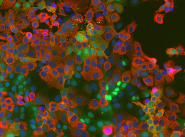 Zellkulturzellen, die einen Kinase-Aktivitätstreporter exprimieren (grün) nach Infektion mit dem humanen Coronavirus HCoV-229E (rot). Zellkerne sind blau gefärbt.