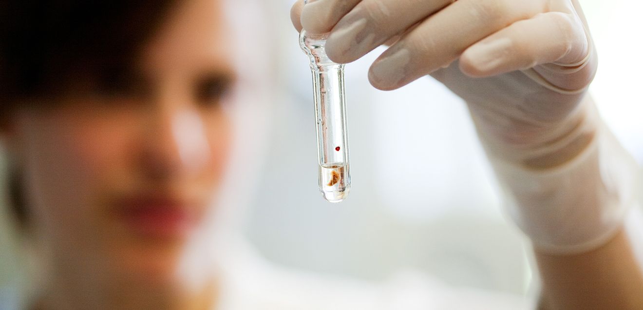 Fluoreszenzmikroskopie: Methode für die Protein-Analyse an Gewebeproben Forschung am UKE - Labormitarbeiterin hält Röhrchen in der Hand