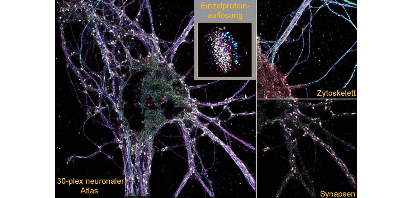 Einzelproteinauflösung durch die Darstellung in einer segmentierten Einzelsynapse Einzelproteinauflösung durch die Darstellung in einer segmentierten Einzelsynapse