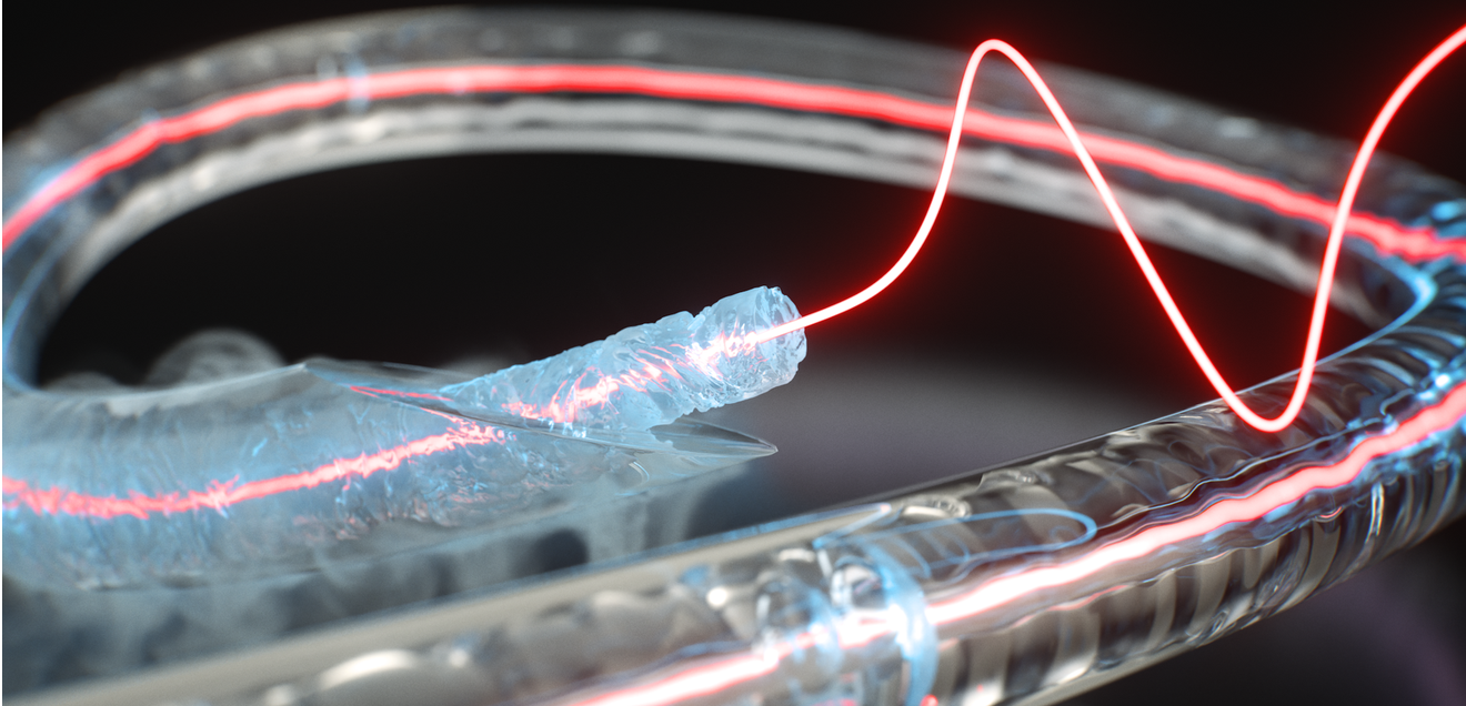 Neue Glasfasertechnologie: Ein ungewöhnlicher Materialzustand eröffnet neue Wege für photonische Systeme Künstlerische Darstellung eines gefrorenen Glasfaserkerns in einer Glaskapillare, der Licht- und Schallwellen effizient leitet und koppelt.