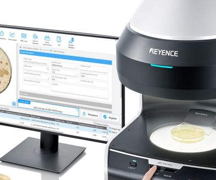 Automatischer Kolonienzähler: Digitalisierter Workflow für mikrobiologische Proben automatischer Kolonienzähler BC-1000