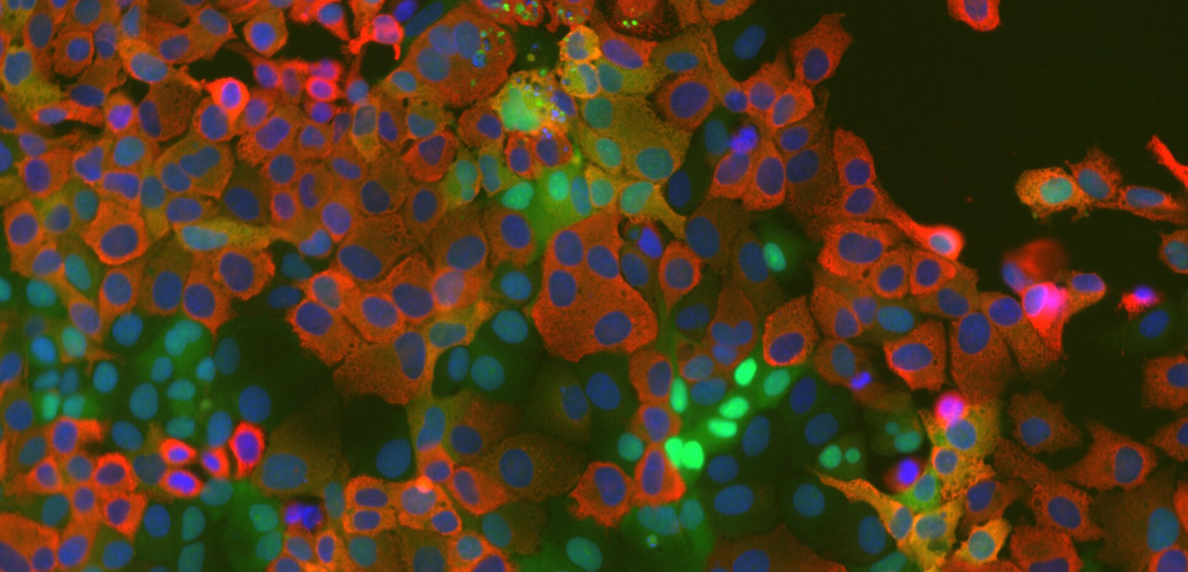 Neuer Ansatz gegen Coronaviren: Forscher entdecken Schlüsselmolekül in der Virusvermehrung Zellkulturzellen, die einen Kinase-Aktivitätstreporter exprimieren (grün) nach Infektion mit dem humanen Coronavirus HCoV-229E (rot). Zellkerne sind blau gefärbt.