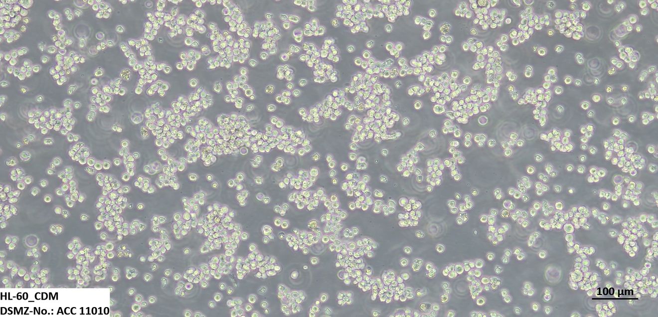 Weniger Tierleid in der Krebsforschung: Zellkulturmodelle ohne fötales Kälberserum Die Zelllinie HL-60 ist ein häufig verwendetes Modell für die akute myeloische Leukämie und kann in einem chemisch definierten Medium ohne den Einsatz von fötalem Kälberserum kultiviert und kryokonserviert werden.