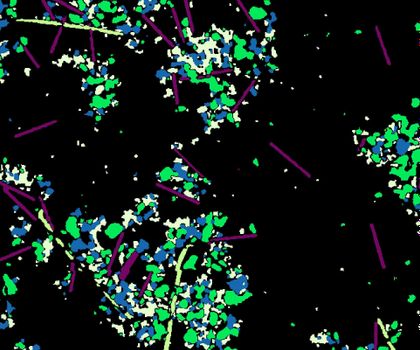Mikroplastik - Kunststoffpartikel verschiedener Form und Größe Kunststoffpartikel verschiedener Form und Größe (Mikroplastik)